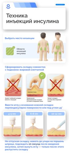 Техника инъекций инсулина